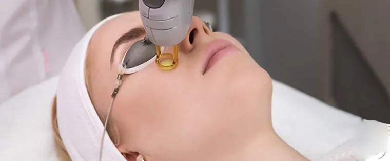 Laser Nd:YAG Q-switched - (Colormax)