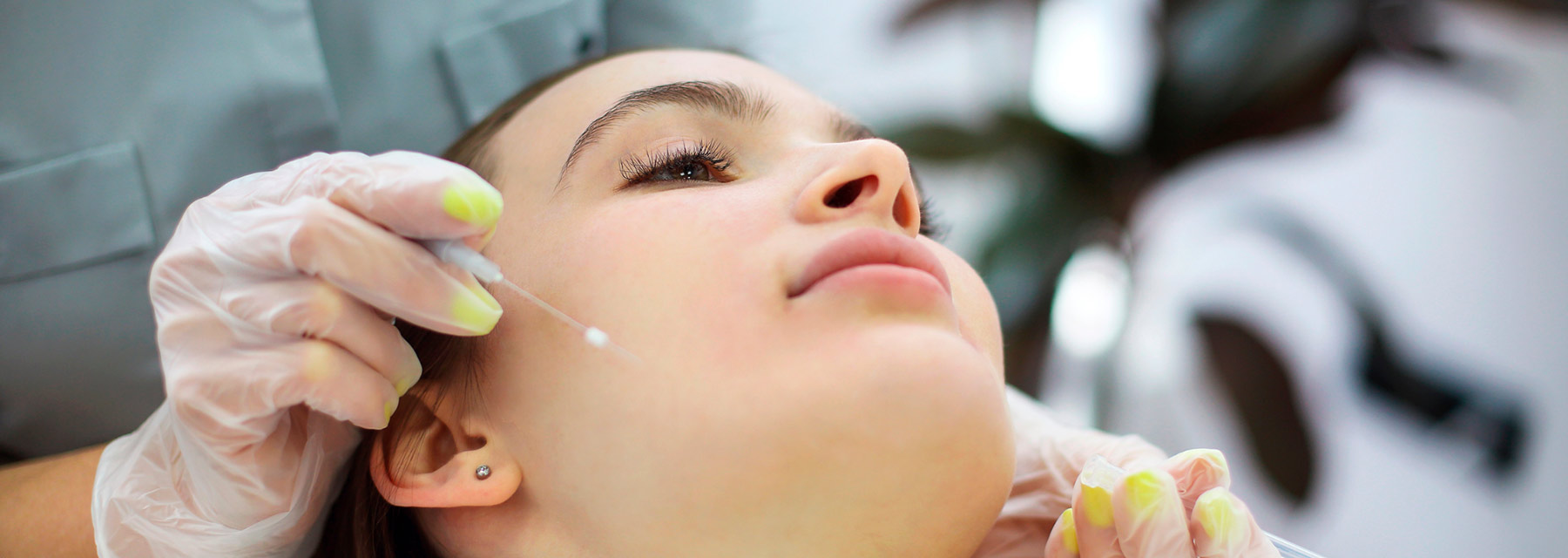 Hilos PDO (Polidioxanona)